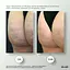 Набір Антицелюлітні ліпосомальні обгортання + рідина Anti-cellulite LPD'S Slimming (6 процедур) Hillary - мініатюра 9