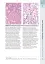 Wheater's Basic Pathology: A Text, Atlas, and Review of Histopathology. International Edition, 5th Edition - мініатюра 12