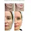 Мікрострумовий ліфтинг-масажер для тіла Medica+ Skin Lifting 5.0   - мініатюра 6