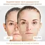 Мікрострум ліфтинг-массажер Medica+ Skin Lifting 6.0 Pink  - мініатюра 6