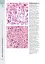 Wheater's Basic Pathology: A Text, Atlas, and Review of Histopathology. International Edition, 5th Edition - мініатюра 11